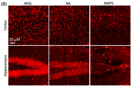 神经元丢失与脑萎缩：NeuN/MAP2染色：显示NA和NAPS小鼠皮质及海马神经元显著丢失