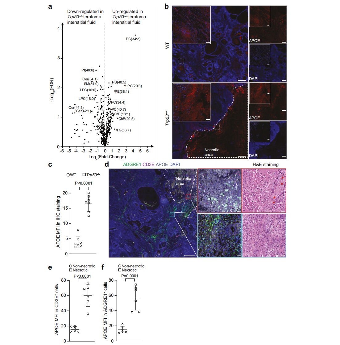 坏死性畸胎瘤细胞向肿瘤微环境释放APOE脂质颗粒